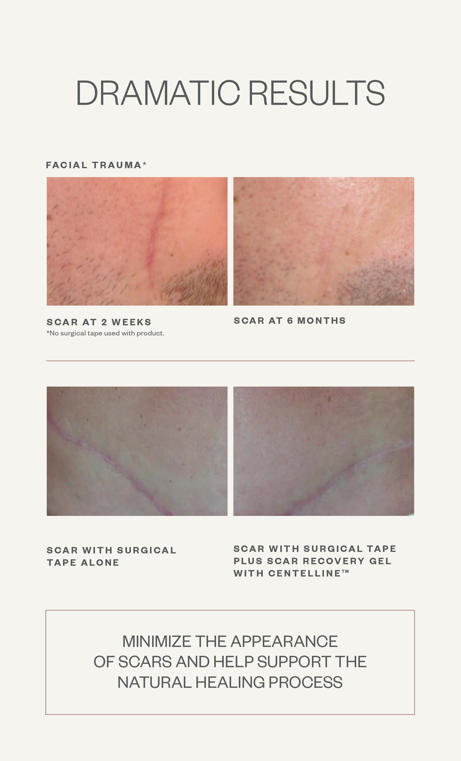 Scar Recovery Gel with Centelline®