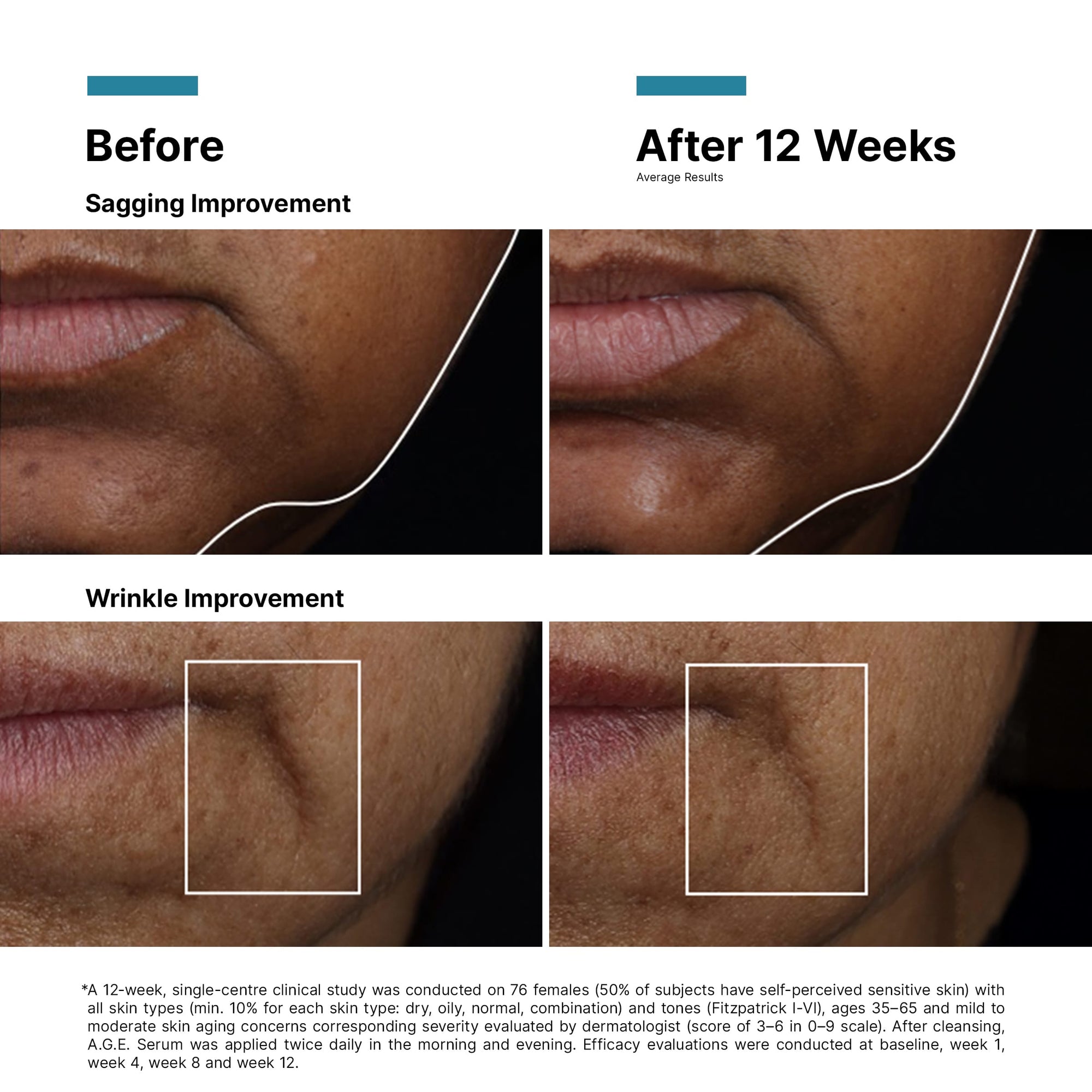 A.G.E. Interrupter Ultra Serum