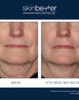 InterFuse Treatment Cream FACE & NECK