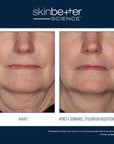 InterFuse Treatment Cream FACE & NECK