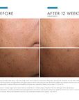 Discoloration Defense
