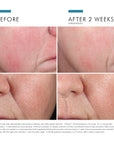 Phyto Corrective Essence Mist