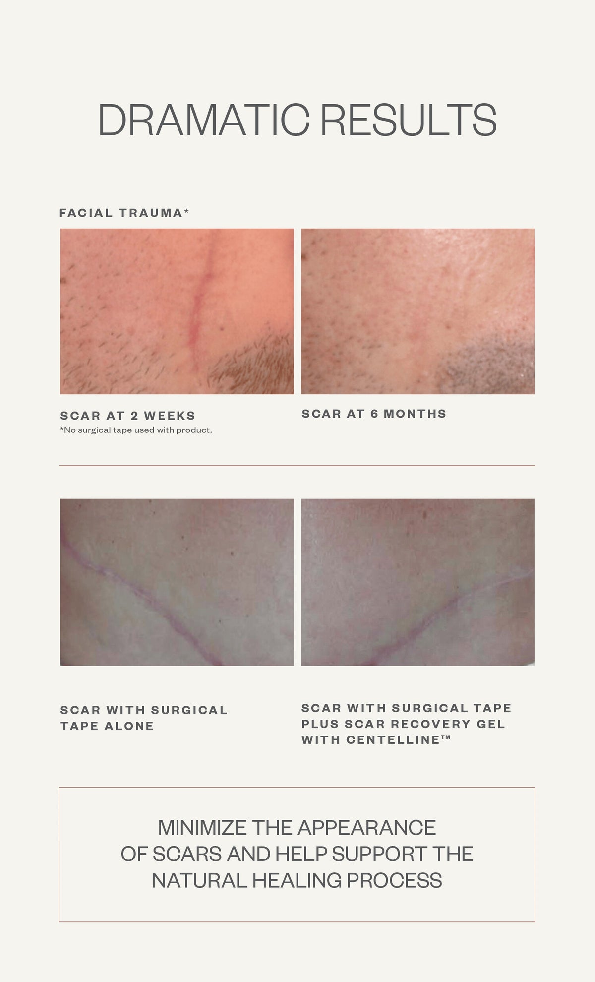 Scar Recovery Gel with Centelline®