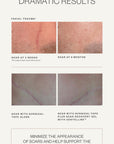 Scar Recovery Gel with Centelline®